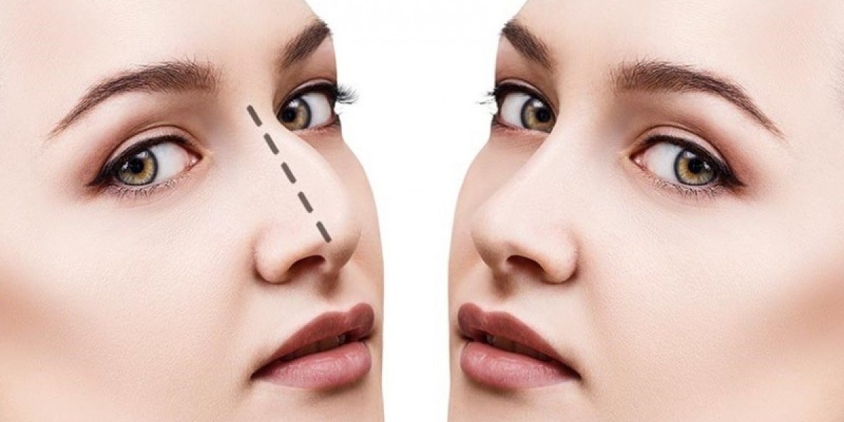 Why Experience Matters in Rhinoplasty in Islamabad