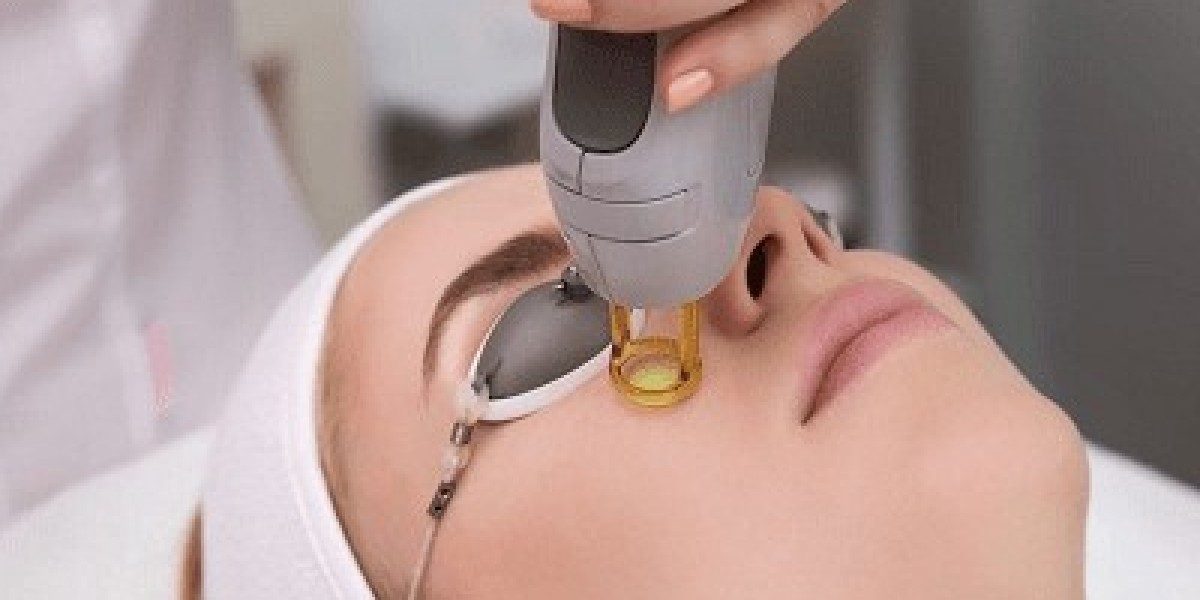 Does Fractional Laser with PRP Help Improve Skin Elasticity?
