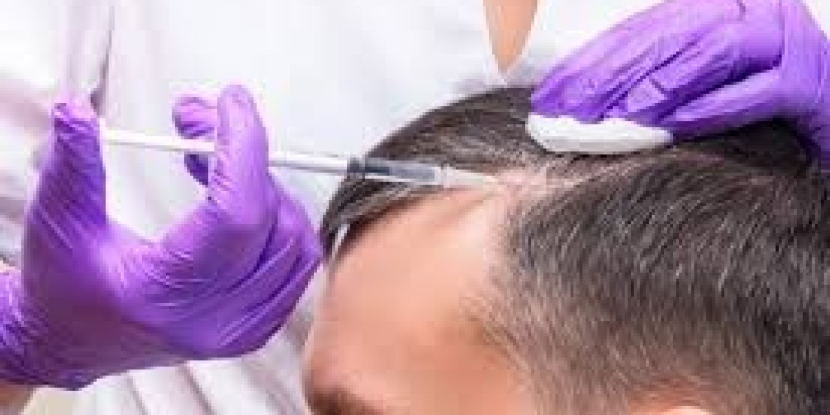 Affordable PRP Hair Regeneration in Dubai — Your Complete Guide