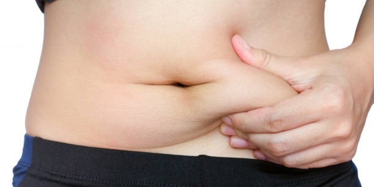 Tummy Tuck and Its Role in Post-Weight Loss Body Shaping