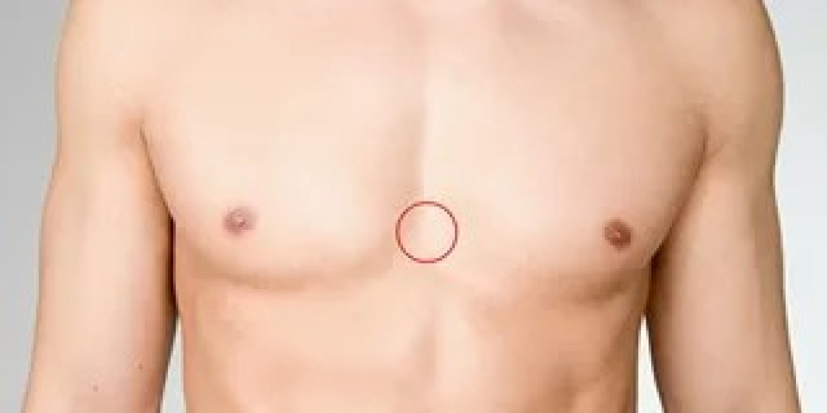 Gynaecomastia Surgery in Dubai: Minimal Scars, Maximum Results