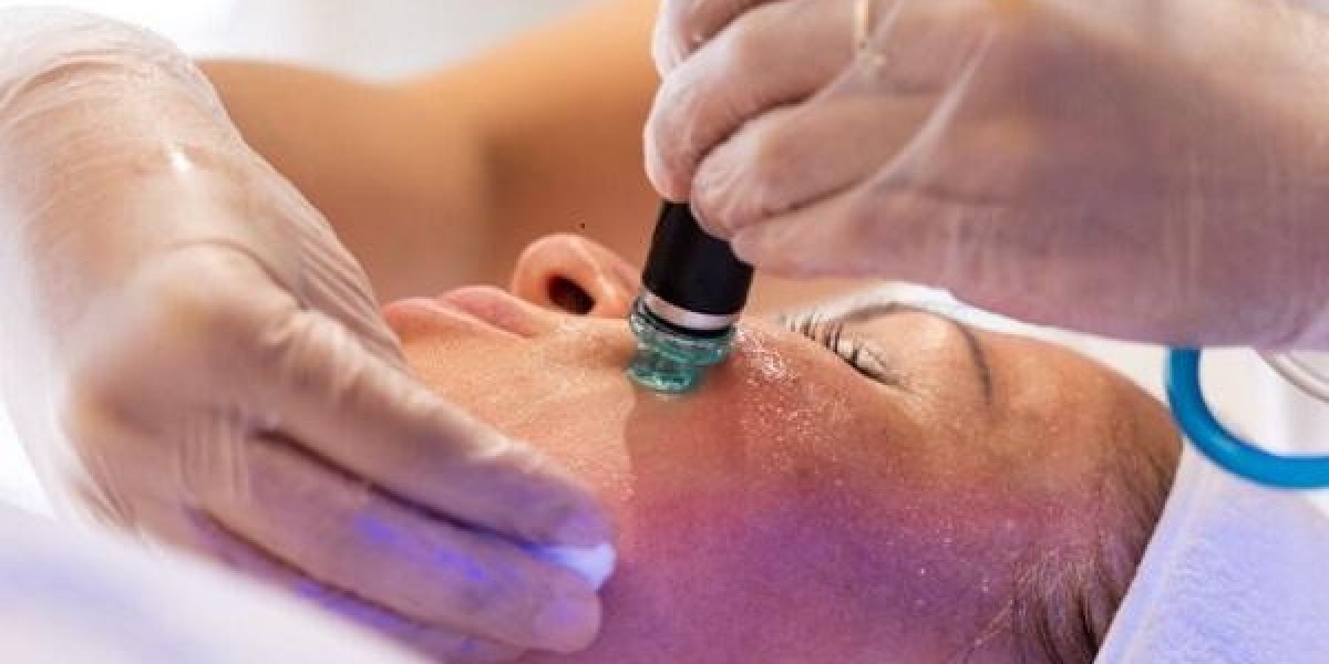 What Is the Cost of Radio Frequency for Acne Scars?