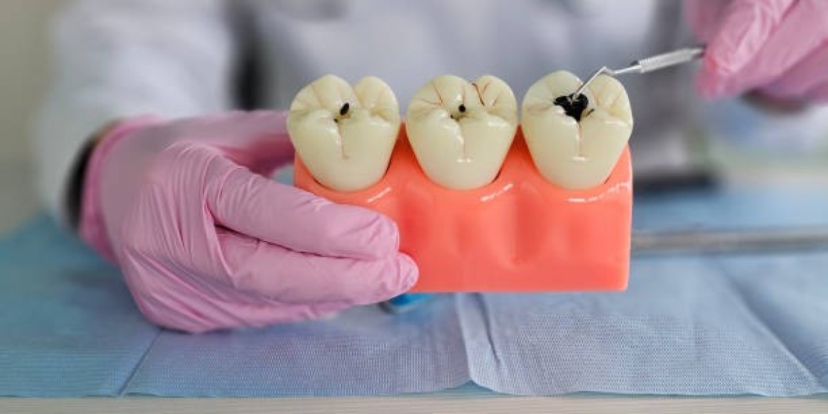 Restore Your Teeth and Smile with Quality Dental Fillings