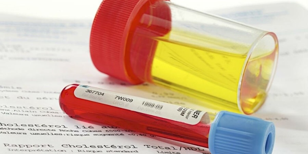 Candida Test Myths vs. Facts: Clearing the Confusion