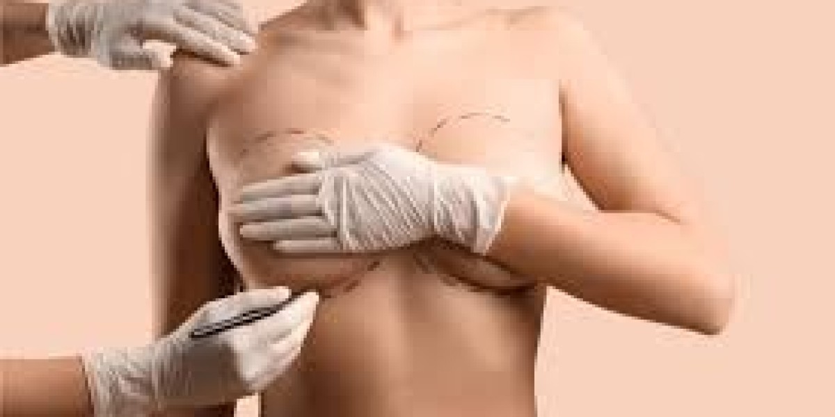 Benefits of Breast Augmentation Dubai for Natural-Looking Results