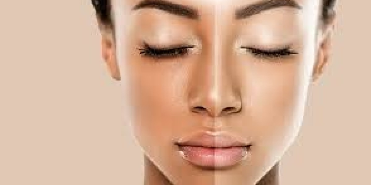Islamabad’s Most Trusted Skin Whitening Clinics