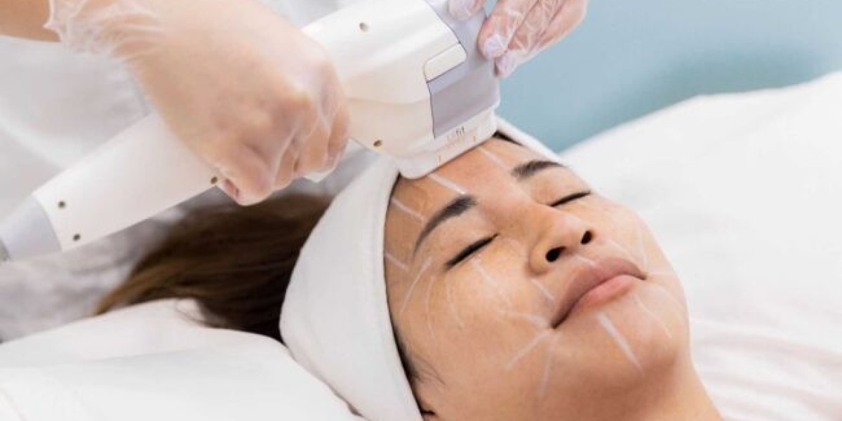 Laser & Advanced Decolletage Whitening in Dubai & Abu Dhabi | Glamorous Clinic
