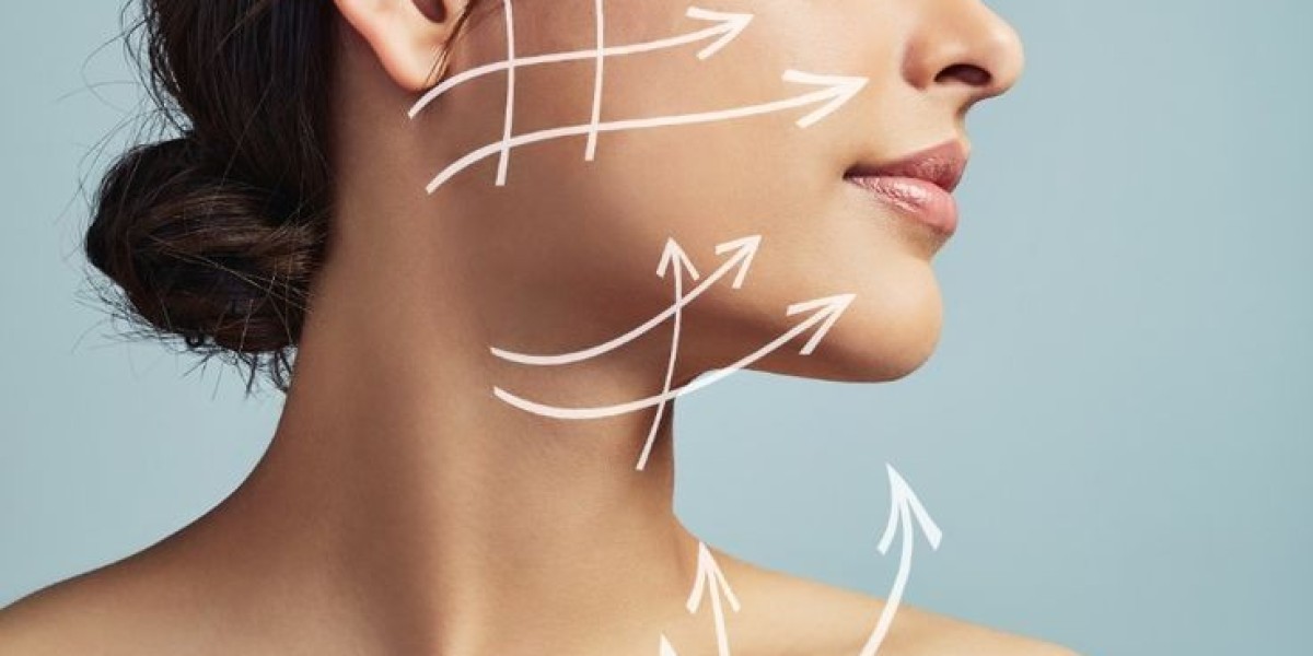Top Reasons Patients Prefer Endolift Treatment in Dubai