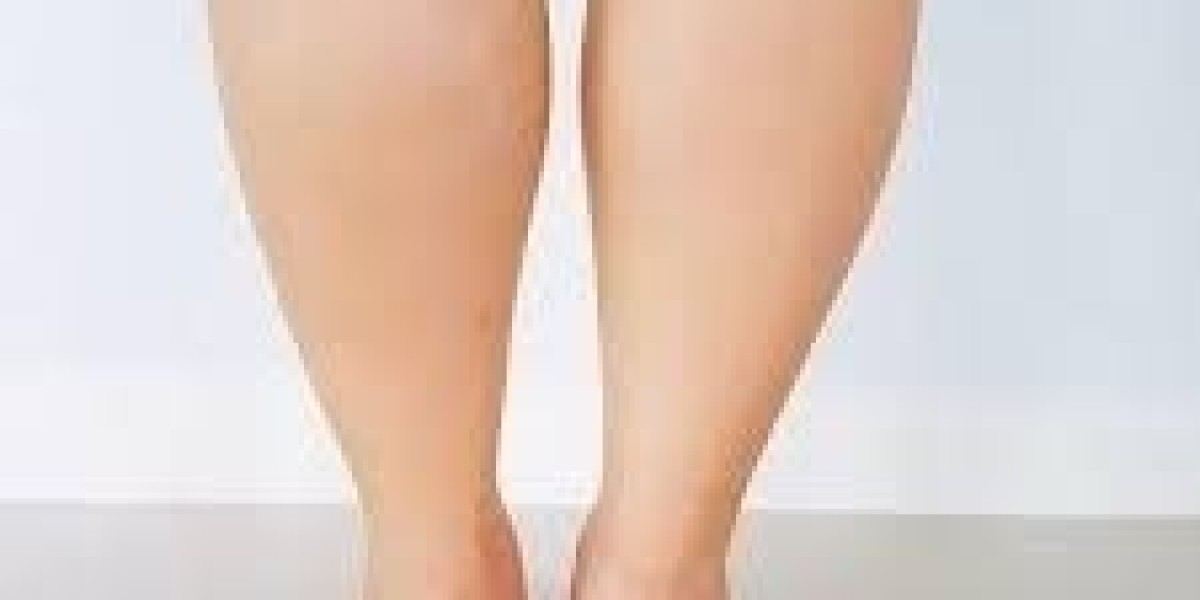 What Is Botox Calf Reduction and Is It Effective?