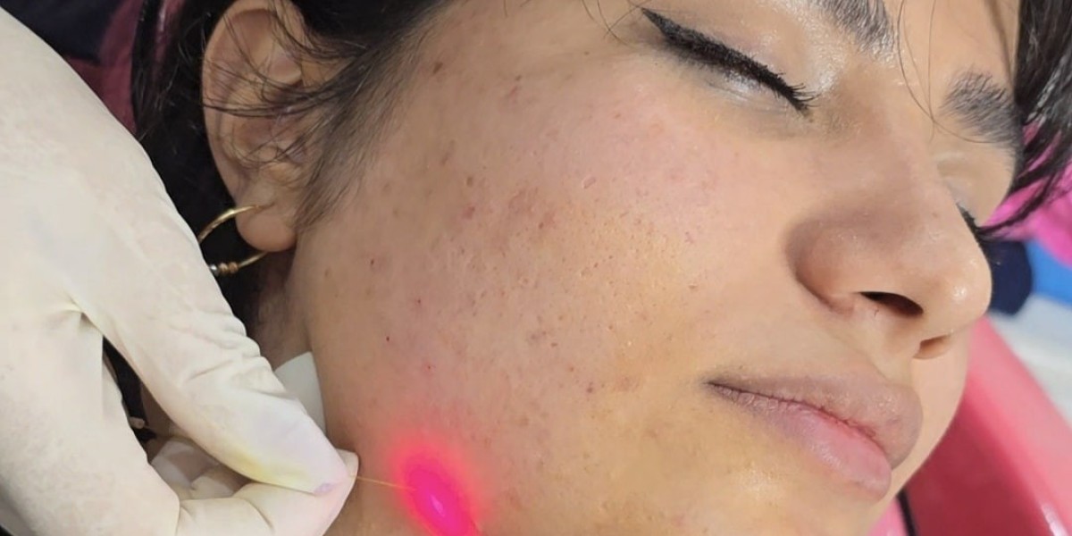 Endolift Treatment in Dubai Recovery Timeline Guide