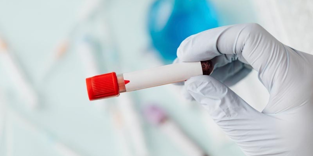 STD Test: How to Stay Calm During Testing