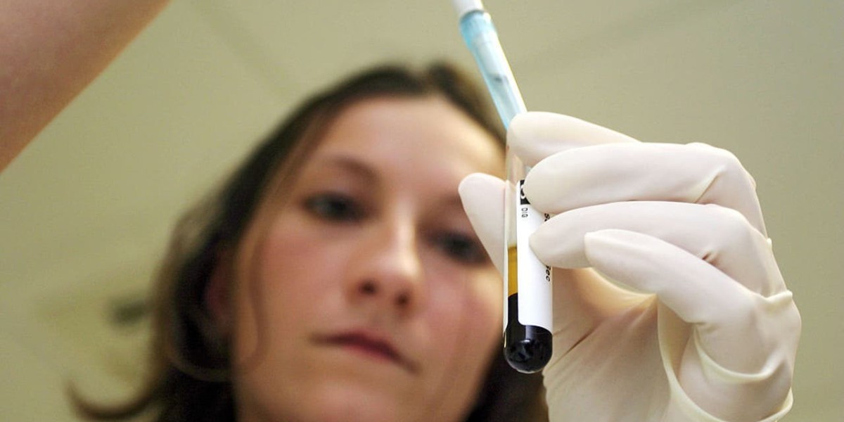 Syphilis Screening and HIV: Why Co-Testing Is Often Recommended