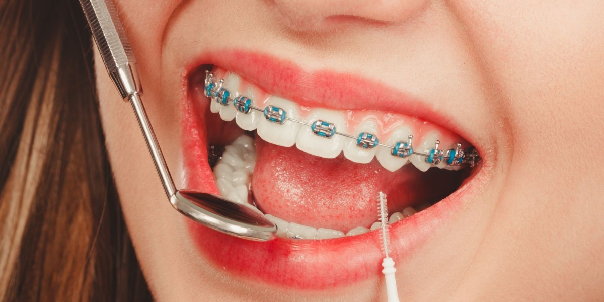 What Dentofacial Orthodontic Treatment Involves