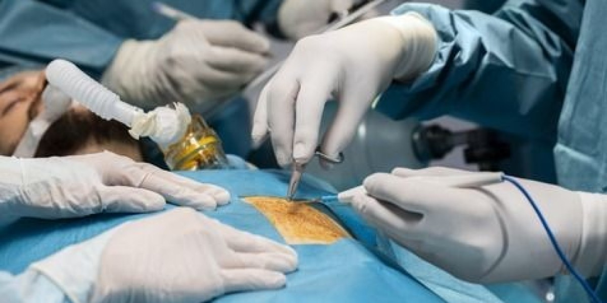 How Is Metabolic Surgery Different From Regular Surgery?
