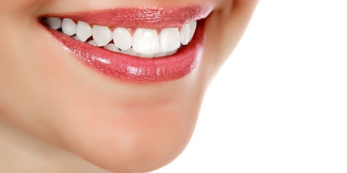Can Hollywood Smile Design Improve Smile Proportions?