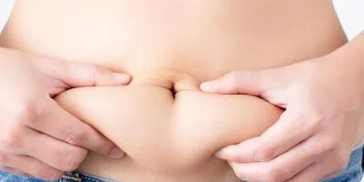 Liposuction in Islamabad: Post-Operative Care Guide