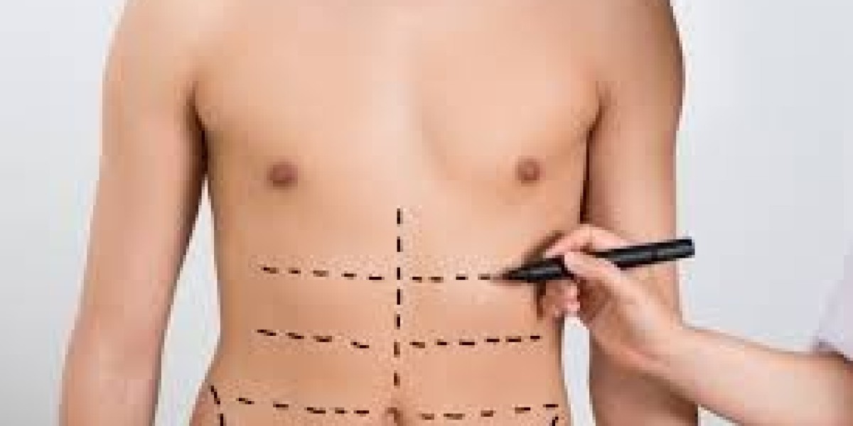 Safe Tummy Tuck in Islamabad: Clinics You Can Trust