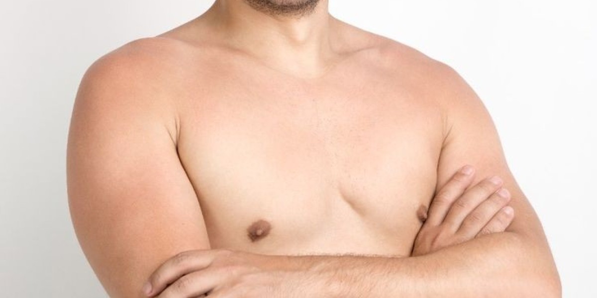 Common Questions Answered About Gynaecomastia Surgery in Dubai