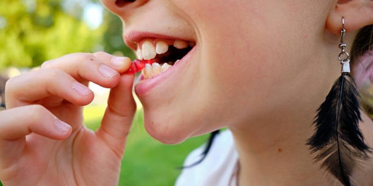 Enhance Facial Harmony with Gummy Smile Treatment in Islamabad