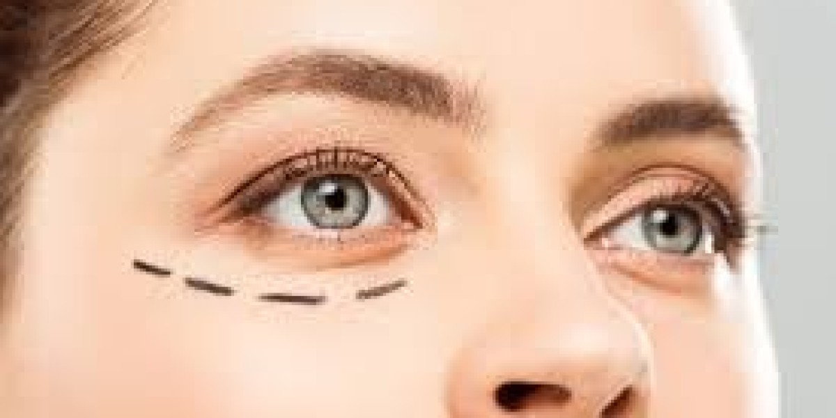 How Surgeons Ensure Natural-Looking Blepharoplasty Results
