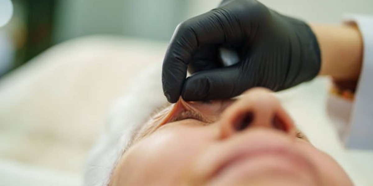 The Role of Eyelid Surgery in Addressing Age-Related Changes