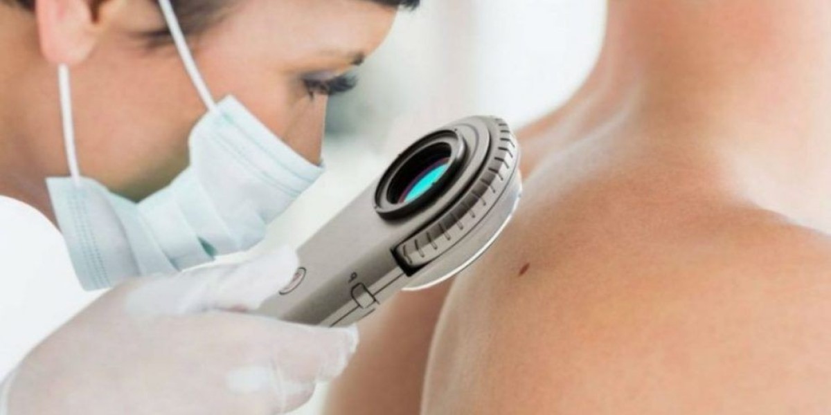Dermatology Treatment Devices Market Set for Explosive Growth Through 2035