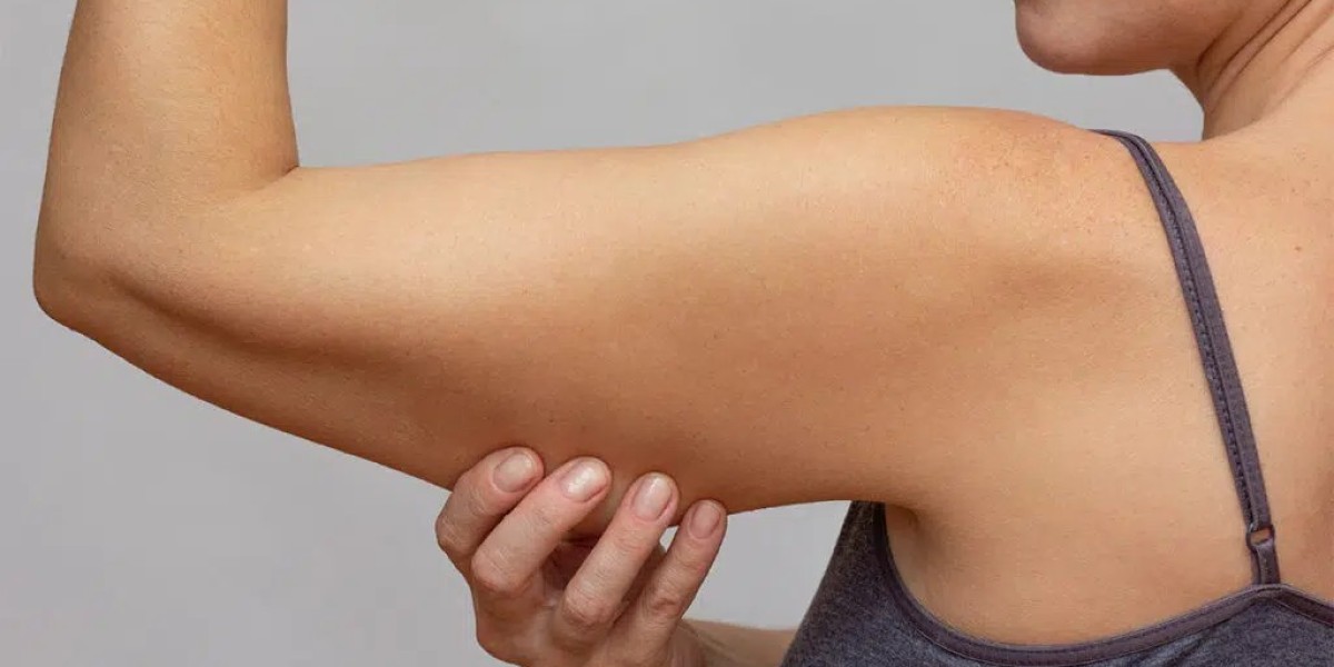 Who Is an Ideal Candidate for Arm Lift Surgery?