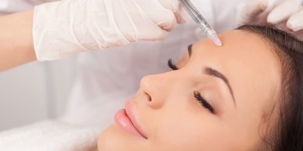 Best Deals for Mesotherapy in Islamabad This Month