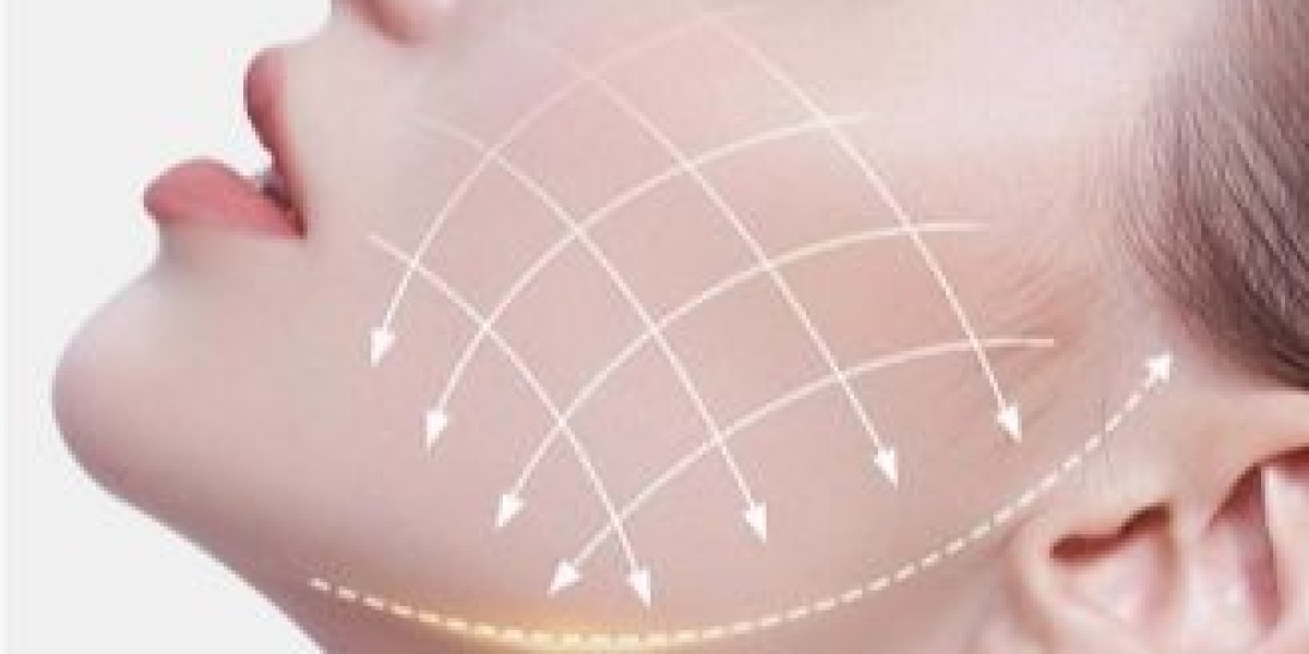 Endolift treatment in Dubai: The Celebrity Secret to Firm Skin
