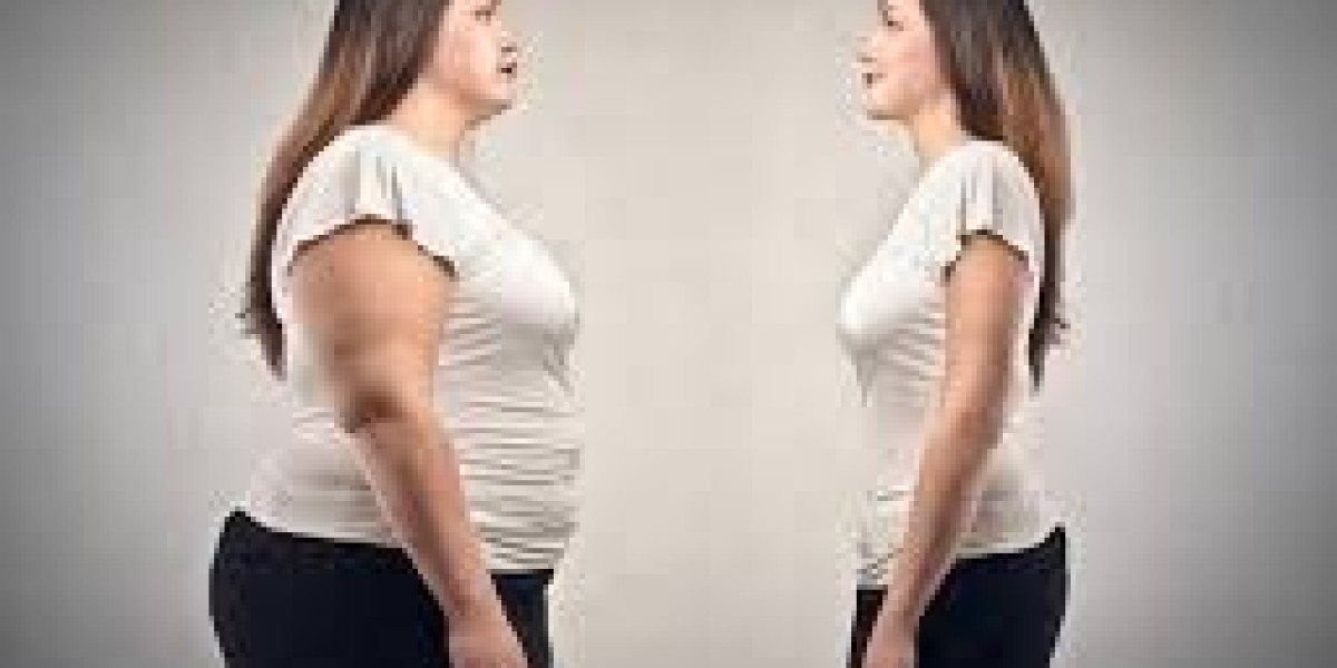 Why Liposuction in Riyadh Leads in Body Sculpting