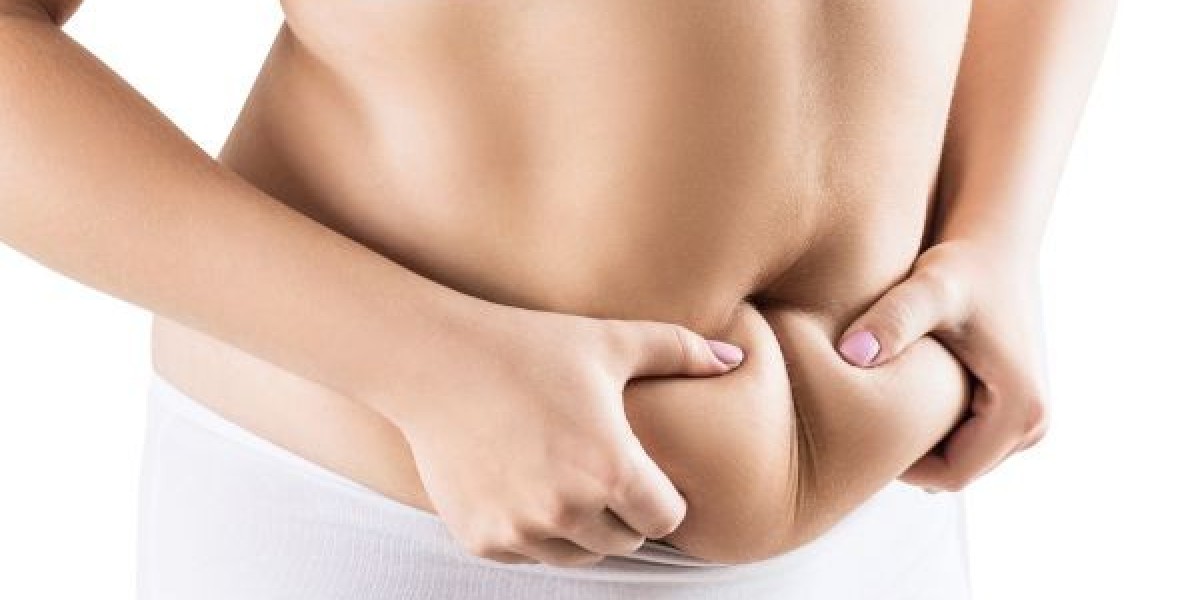 Fat Melting Injection in Dubai: What Modern Aesthetic Clinics Offer