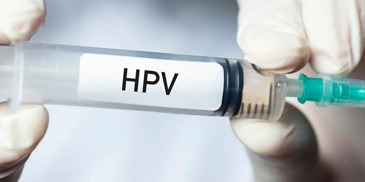 When Should You Get an HPV Test? A Complete Guide
