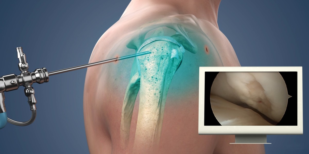 Shoulder Injury & Surgery Detroit, MI | Trusted Orthopedic Care