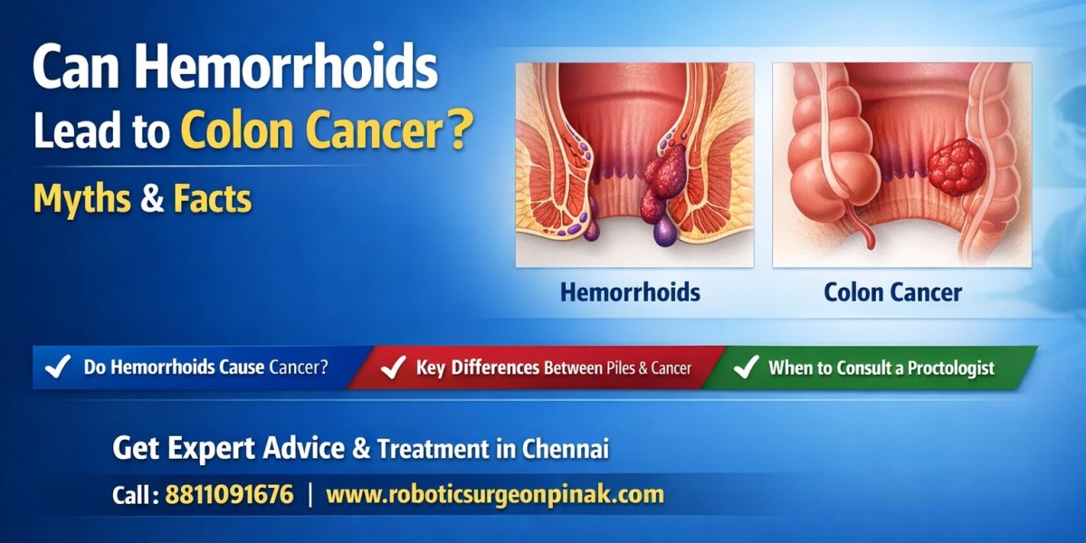 Can Hemorrhoids Lead to Colon Cancer? Myths & Facts