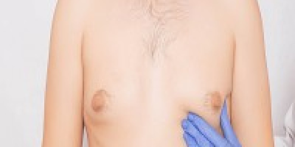 Minimally Scar Technique for Gynecomastia In Islamabad