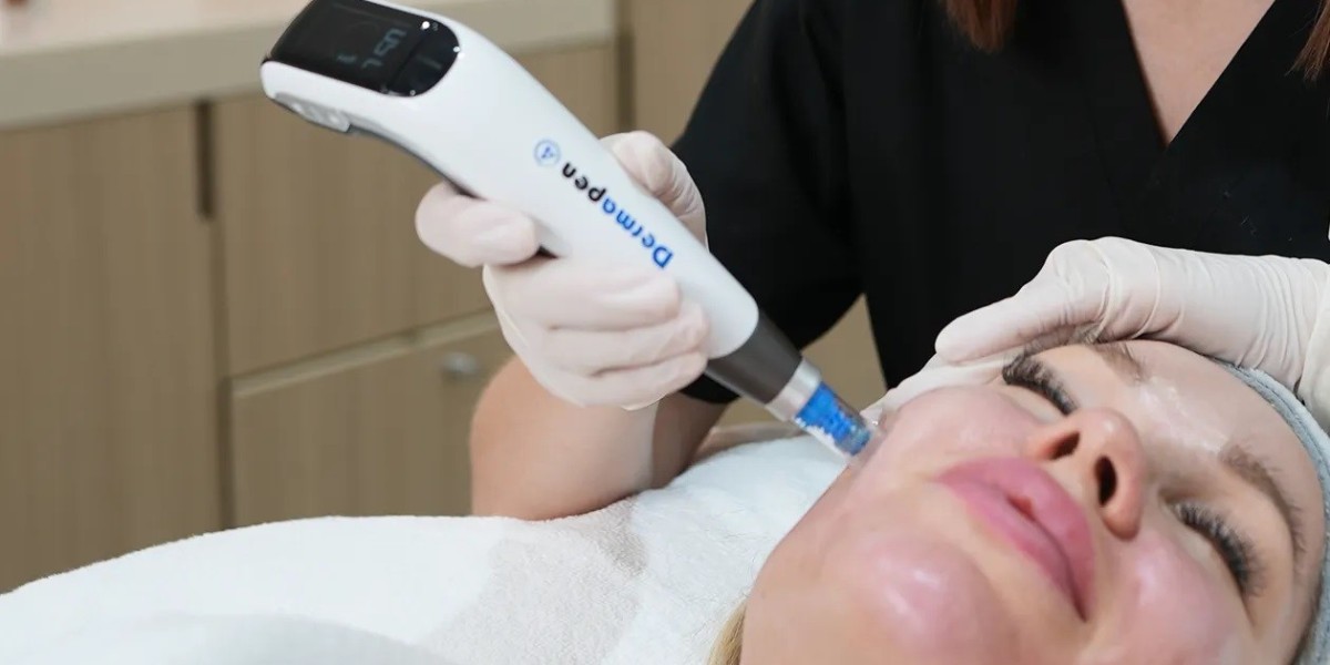 How Mesotherapy in Islamabad Helps You Look Younger Naturally