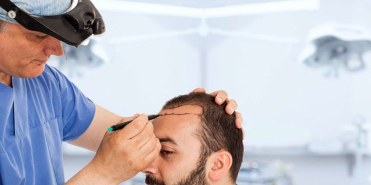The Art of the Graft: Designing the Perfect Hairline in Riyadh’s Premier Clinics
