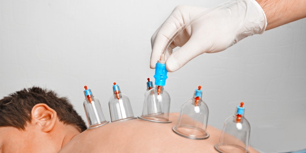 Why Do Experts Discuss Hijama Treatment Cost in Dubai?