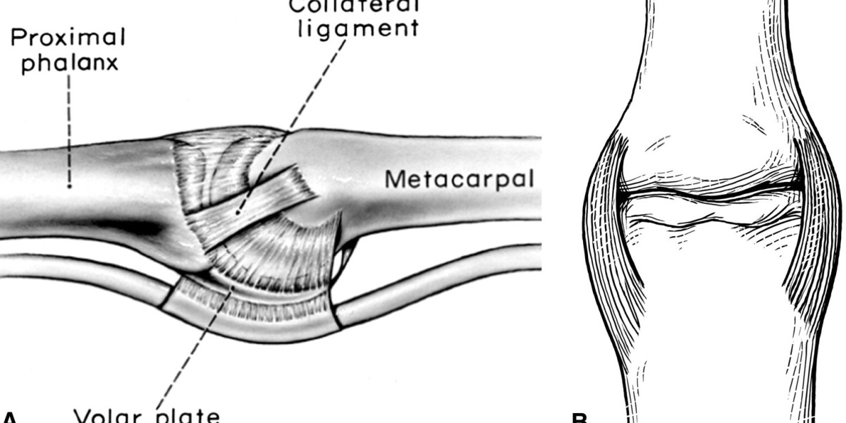 Collateral Ligament Stabilizer System Market: Strengthening Recovery and Performance in Orthopedic Care