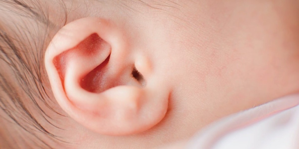 Ear Reshaping in Riyadh: A Guide to Otoplasty and Symmetry