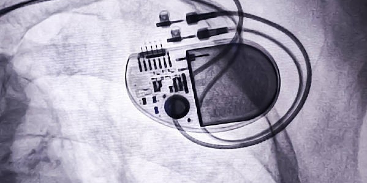Global Implantable Medical Devices Market Analysis: Key Drivers and Industry Insights