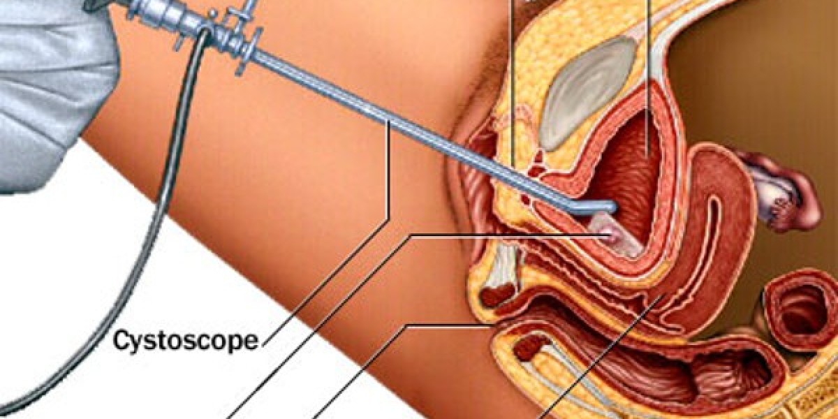 Cystoscope Market Insights and Analysis [2025–2034] | Industry Performance, Growth Opportunities, Risk Factors, Strategi