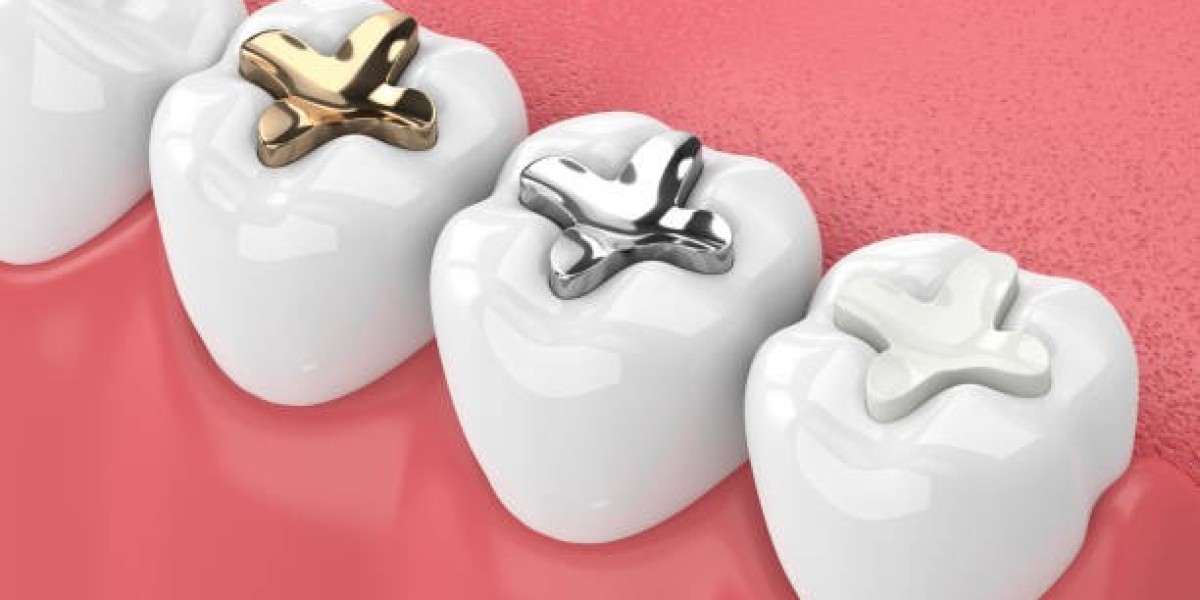 Professional Dental Filling in Islamabad for Healthy Smiles