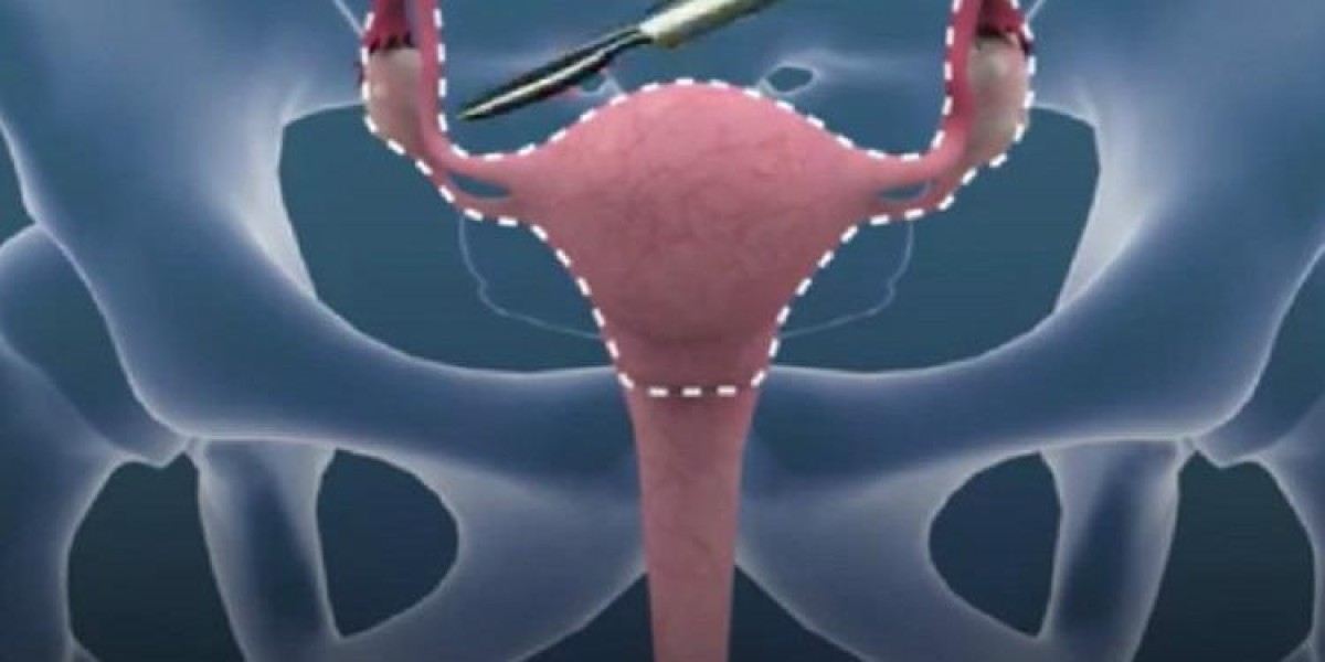 Sex Reassignment Surgery Market Growth Fueled by Surgical Advancements