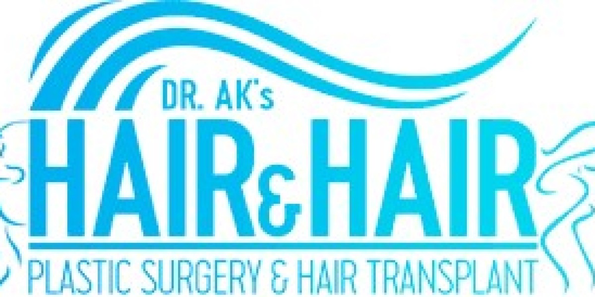 Hair Transplant in Islamabad – A Complete Guide to Restoring Your Confidence