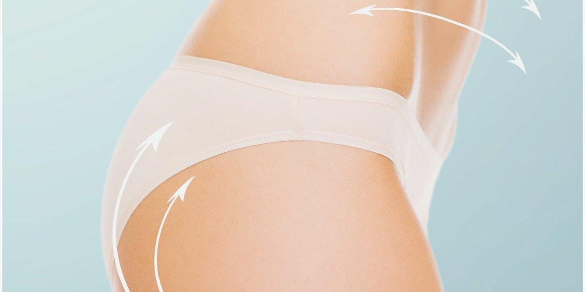 Beyond the Scalpel: Liposuction's Role in Holistic Body Wellness