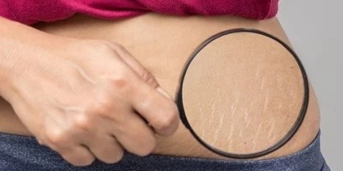 How to Regain Smooth Skin in Islamabad