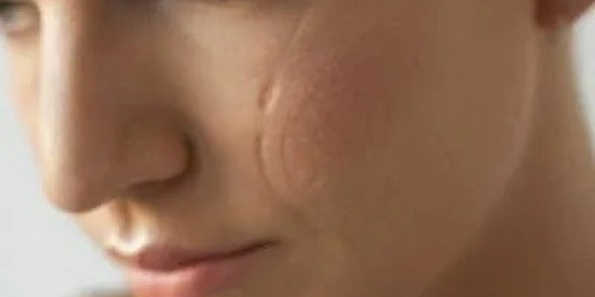 How Scar Revision Boosts Confidence and Appearance