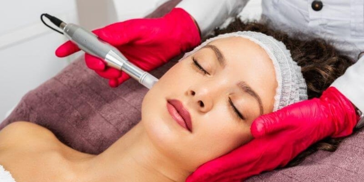 Does Microneedling Help Reduce the Appearance of Enlarged Pores?
