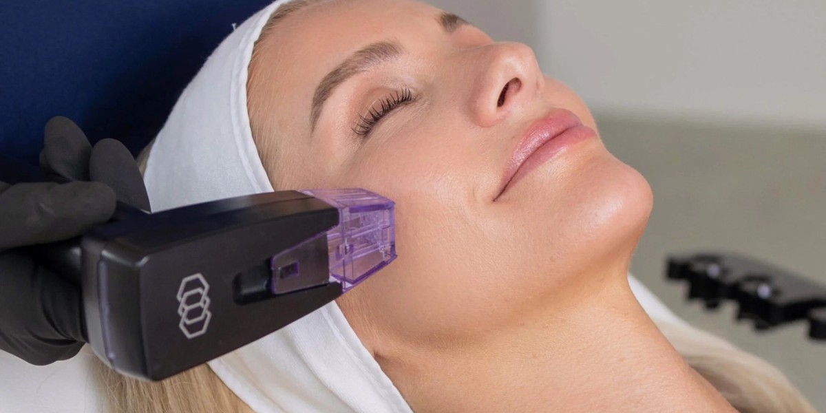 How Often Should You Get Laser Skin Tightening?